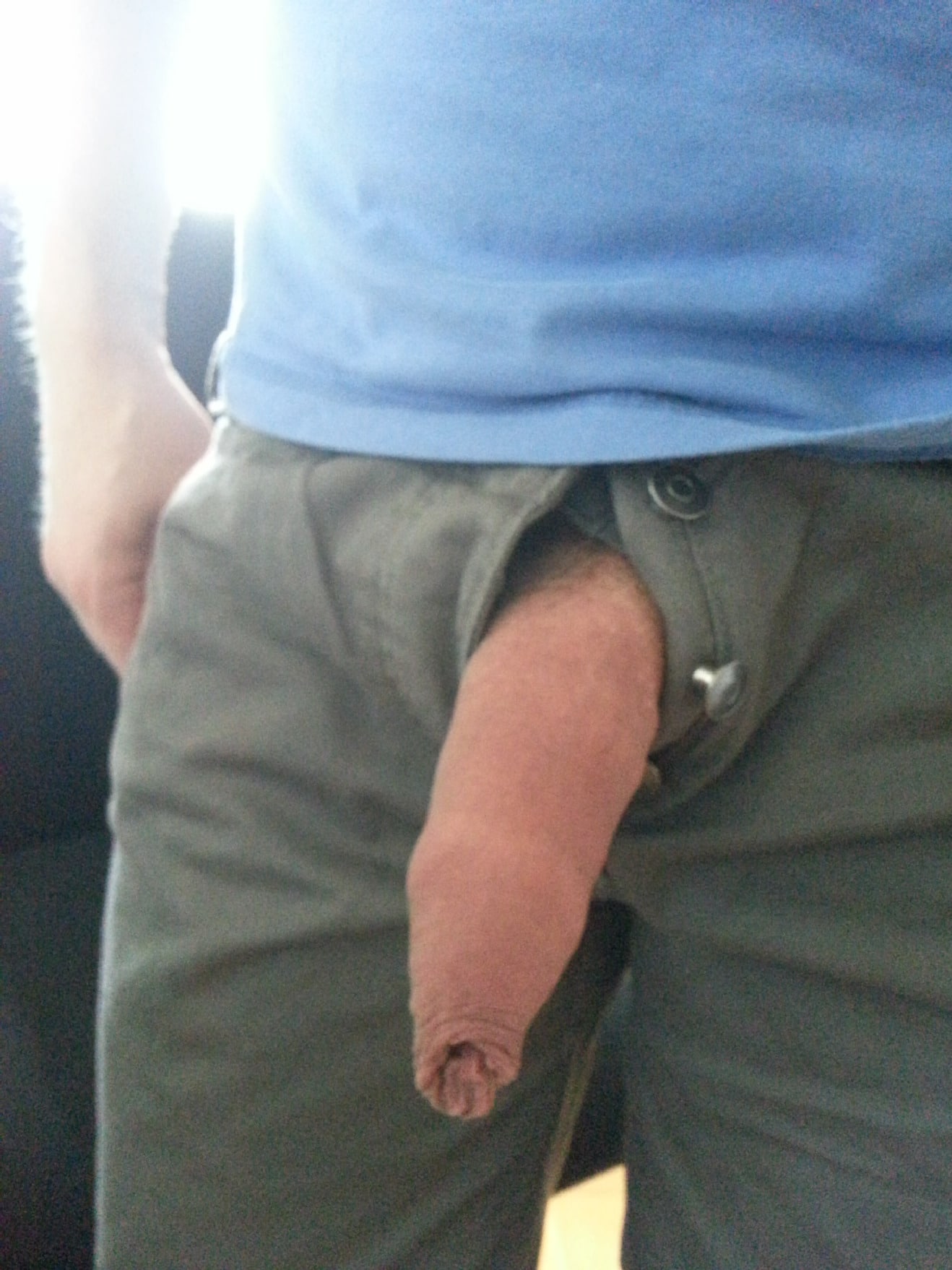 Uncut Penis Picture 105